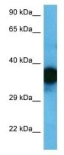OR1F1 Rabbit anti-Human, Polyclonal, Novus Biologicals:Antibodies:Primary